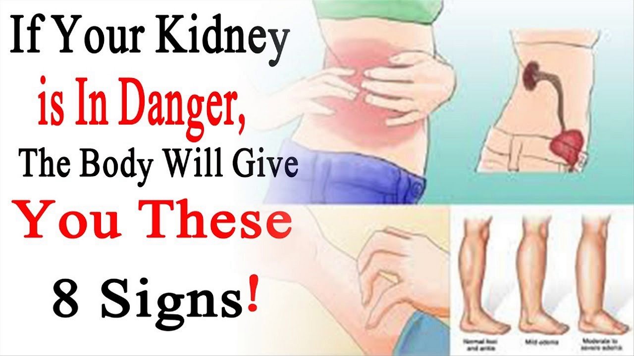 Can Back Pain Mean Kidney Problems - HealthyKidneyClub.com