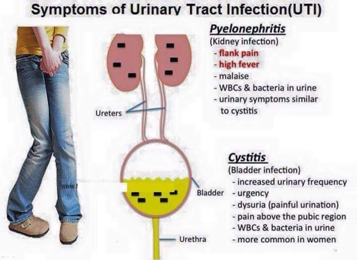 is-bladder-and-kidney-infection-the-same-thing-healthykidneyclub