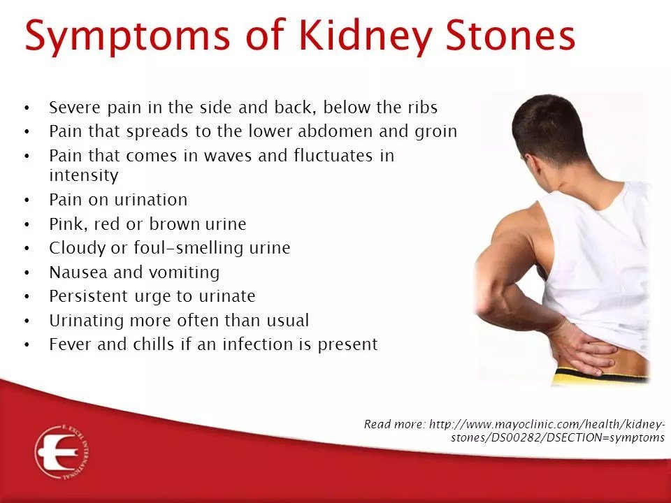 Where Is Kidney Stone Pain Felt In The Back